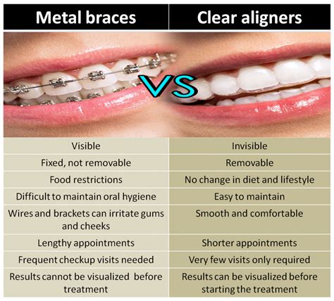 The Difference Between Clear Braces and Clear Aligners .